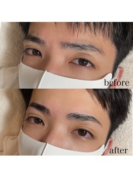 ダリ(Dali)/メンズハリウッドブロウリフト