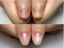 マイントゥ ネイル(mine too nail)/育成ネイルでコンプレックス解消