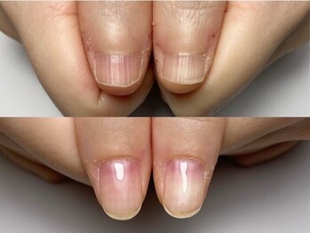 マイントゥ ネイル(mine too nail)/育成ネイルでコンプレックス解消