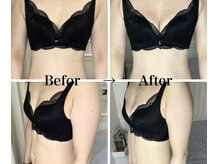 ブレスト 新宿本店(Breast)/《7回目》30代（バストアップ）