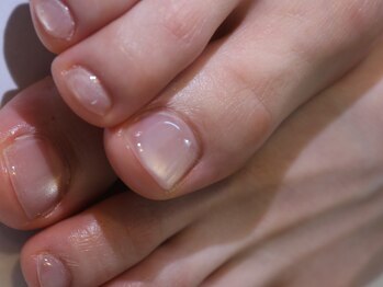 クロ(KURO)/うるマグ/柳津ネイルサロン