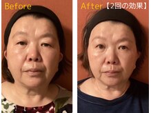 ロイヤリティ(ROYALTY)の雰囲気（【筋膜ケア◆強力小顔機器矯正】小顔造形/浮腫み悩みを徹底改善!）