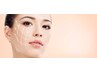 《フェイシャル》リフトアップ・小顔