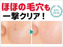 サロンド ケイティ(Salon de Katy)の雰囲気(取れた角栓が見れる!毛穴洗浄/毛穴/毛穴黒ずみ/毛穴ケア/毛穴)