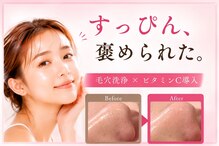 ハレハダ(HAREHADA)