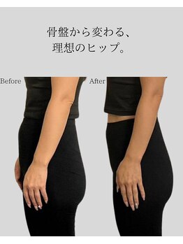 リ バース 立川(RE:birth)/美尻変化　BeforeAfter
