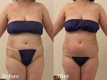 ラヴィエ ベル(La vie est belle)/上半身