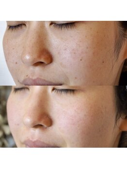 ザ シー タイムレスビューティ(THE SHE)/30代お客様症例写真