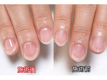 ブライト ネイル スペース 恵庭(Bright Nail Space)の写真/爪の悩みを丁寧にケア◎形や乾燥などお悩み解決◆整った爪はずっと見つめていたくなる指先へと変身♪