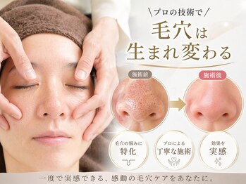 シアン(CYAN)の写真/＜長年のお悩み毛穴に！＞話題の毛穴エクストラクションですっぴん美人に♪