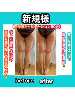 ビューティ ウィッチ(Beauty Witch)/冬は凸凹脂肪が増える季節