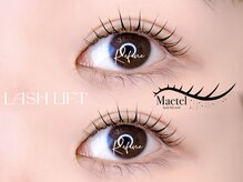 リファイン(Refine)/メーテルロット