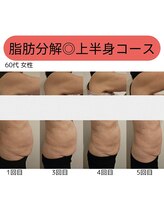 ウル バイ ラシック(Ulu by Lasic)/【脂肪分解】上半身ダイエット◎