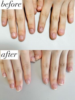 ニコワイズネイル(Nico Y's Nail)/【自爪育成コース】