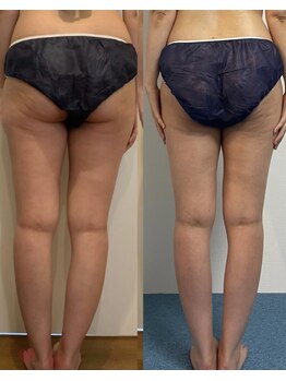 シェリスパ(Cheri Spa)/脚も理想通りに痩せます★