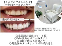 ピノ(PINO)の雰囲気（完全個室のホワイトニングルーム☆）