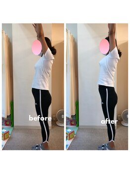 みらい整骨院/肩甲骨剥がしで肩こり改善