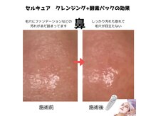 ブーケの雰囲気（毛穴の汚れがとれてずっと触りたくなるくらいすべすべに！）