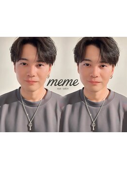 メンズフェイシャル