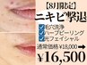 【頑固なニキビを徹底ケア】ハイドラ毛穴洗浄+ピーリング+光フェイシャル