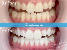 ホワイトニングカフェ 荻窪店(WhiteningCafe)