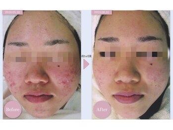 ルー(Lu)/肌トラブルもご相談ください