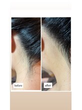 ツヤ(Tsuya)/うなじ剃り