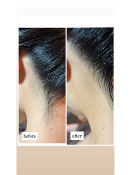 ツヤ(Tsuya)/うなじ剃り