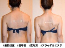 アンシャンテ 芦屋店/ブライダル【姿勢矯正】芦屋西宮