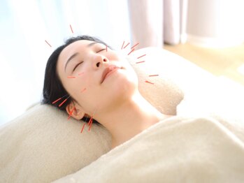 ナツメ鍼灸院(natume鍼灸院)/美容鍼灸/むくみ・たるみ・美肌