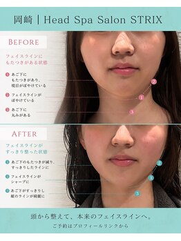 ストリクス(STRIX)/before / after【ヘッドスパ】
