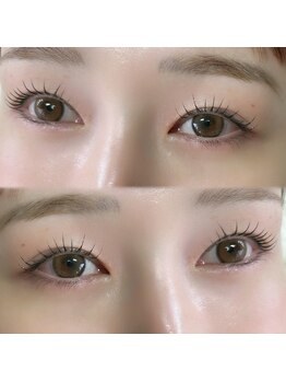 ナル(NaLu)の写真/丁寧なカウンセリングで理想の瞳を追求。ダメージレスでキープ力抜群のデザイン◎