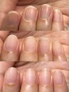 お客様Beforeafter　3か月