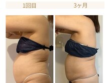 カレンシーサイドビューティー(夏恋SeasideBeauty)の雰囲気（寝るだけボディメイク、3ヶ月、6ヶ月、1年通い放題コースあり！）