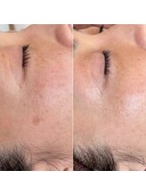 ジン フォー ユアビューティー(JIN for your beauty)/施術経過