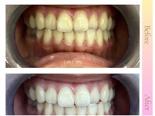 エクシアホワイト 宮崎末広店/