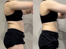 エルディジムズ サッポロ(LD GYM’s sapporo)/お客様のビフォアフターです♪