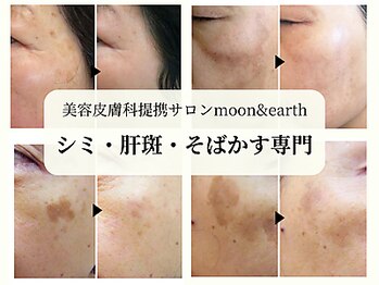 ムーンアンドアース(moon&earth)