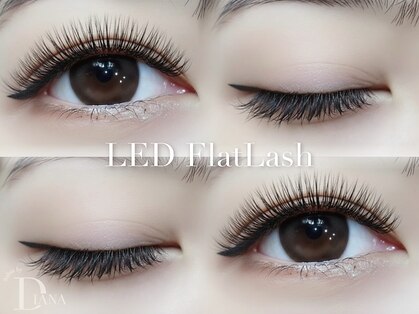 ディアナ(DIANA)の写真