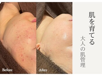 ヴィヴィアン 熊谷店(Vivian)/【本気でお肌を変えたい方】