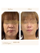 リサプリ(Re: Supple)/大人肌のハリ艶・透明感ケア