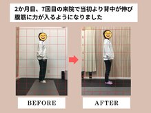富雄みなみ整骨院/施術後ビフォーアフター