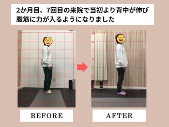 富雄みなみ整骨院/施術後ビフォーアフター