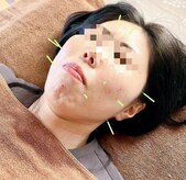 つむぎ養生堂マッサージ処
