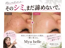 ミュベル(Myubelle)