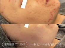トップスキン 名駅(TOPSKIN)