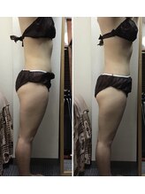 ミマインズ 倉敷本店(Me Mines)/引き締めたい！