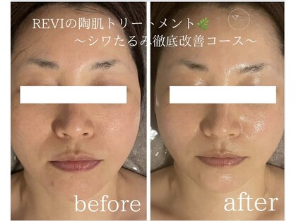 リル(rire)の写真