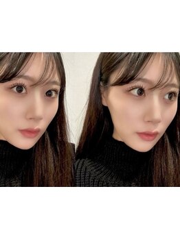 ナチュラル上品な目元にしたい