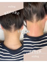 ホワイトワックス 京都四条烏丸(WHITE WAX)/WAXでうなじ美人！